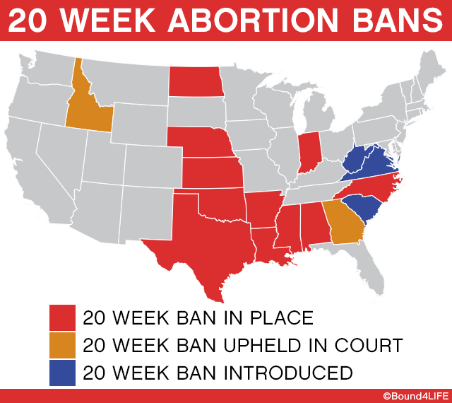 20weekabortionban